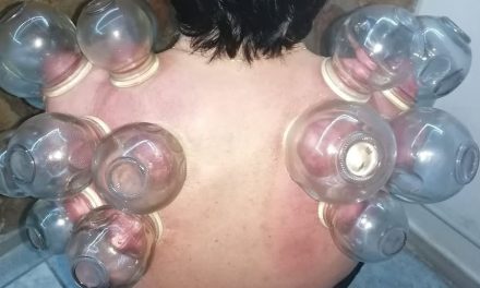 Coppettazione Spalle